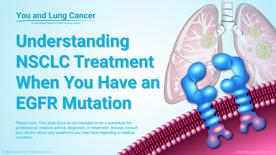Understanding NSCLC Treatment When You Have an EGFR Mutation