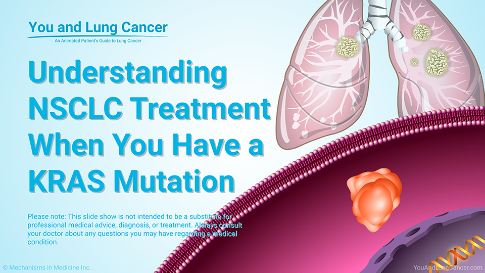 Understanding NSCLC Treatment Options When You Have a KRAS Mutation