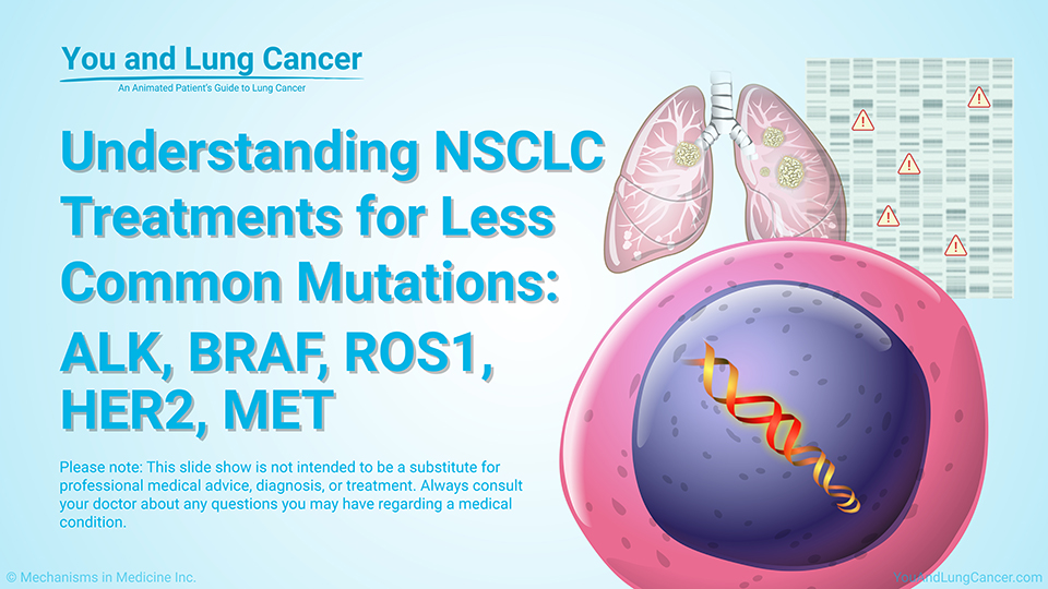 Understanding NSCLC Treatment for Less Common Mutations: ALK, BRAF, ROS1, HER2, MET