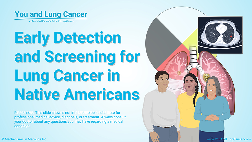 Slide Show - Early Detection and Screening for Lung Cancer in Native Americans