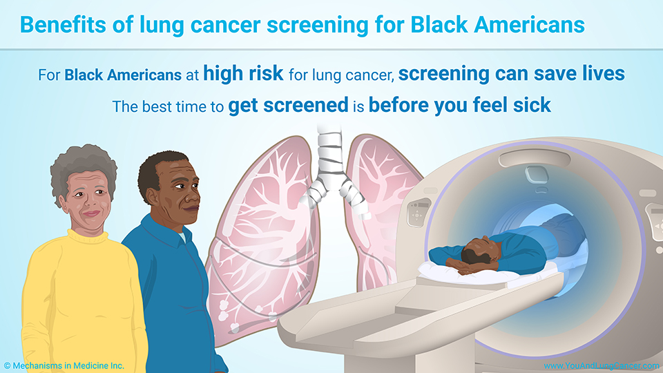 Benefits of lung cancer screening for Black Americans
