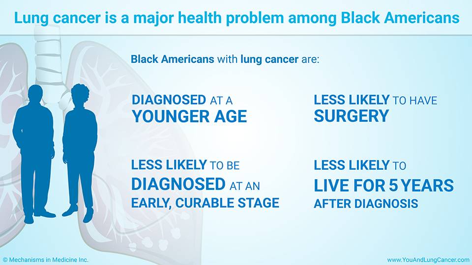 Lung cancer is a major health problem among Black Americans 