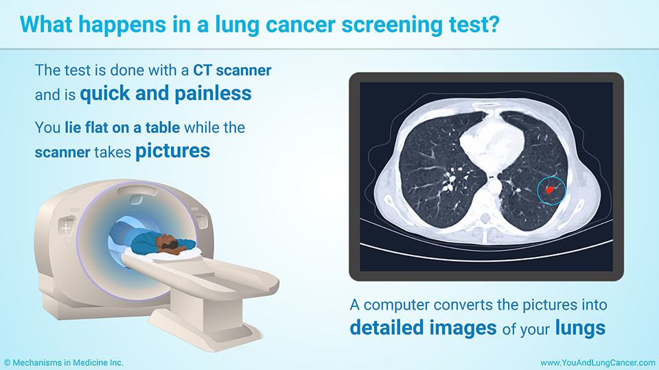 What happens in a lung cancer screening test?