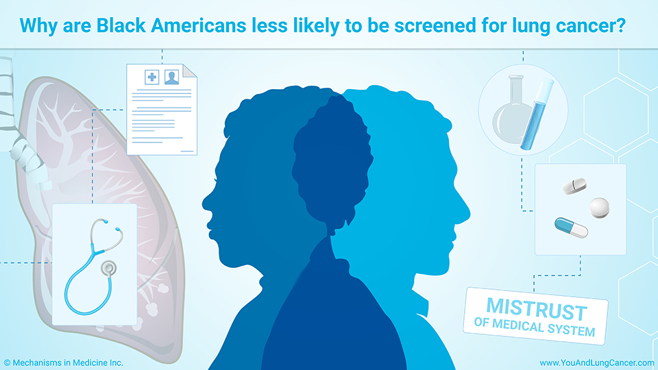 Why are Black Americans less likely to be screened for lung cancer?