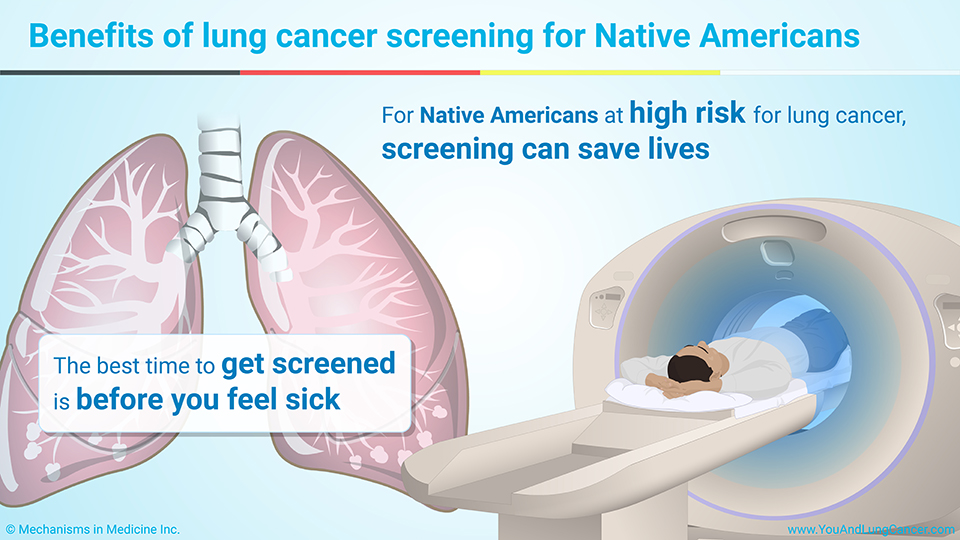 Benefits of lung cancer screening for Native Americans