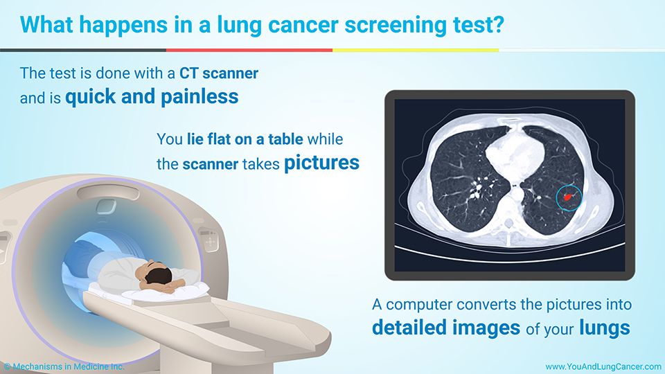 What happens in a lung cancer screening test?