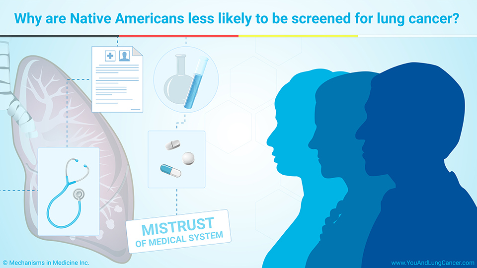 Why are Native Americans less likely to be screened for lung cancer?