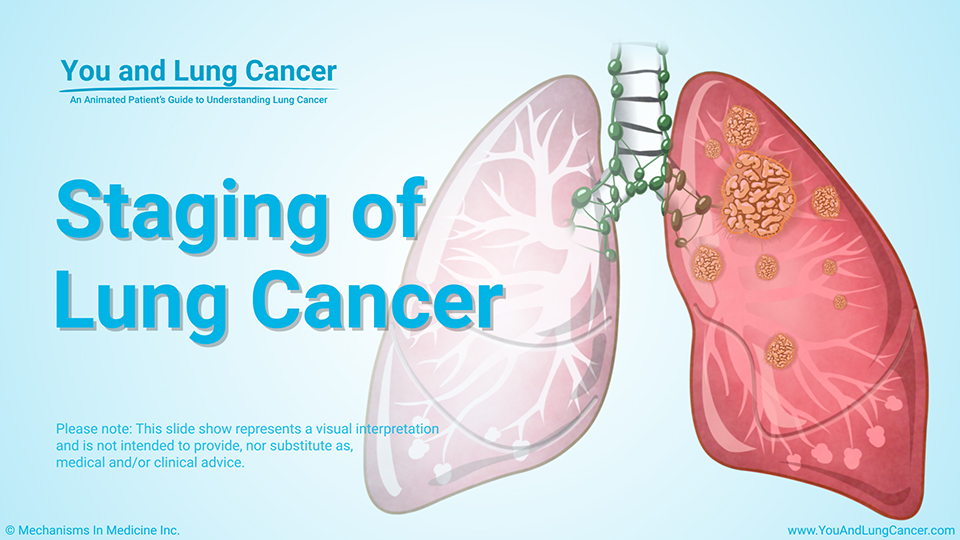 the diagnosis and staging of cancer