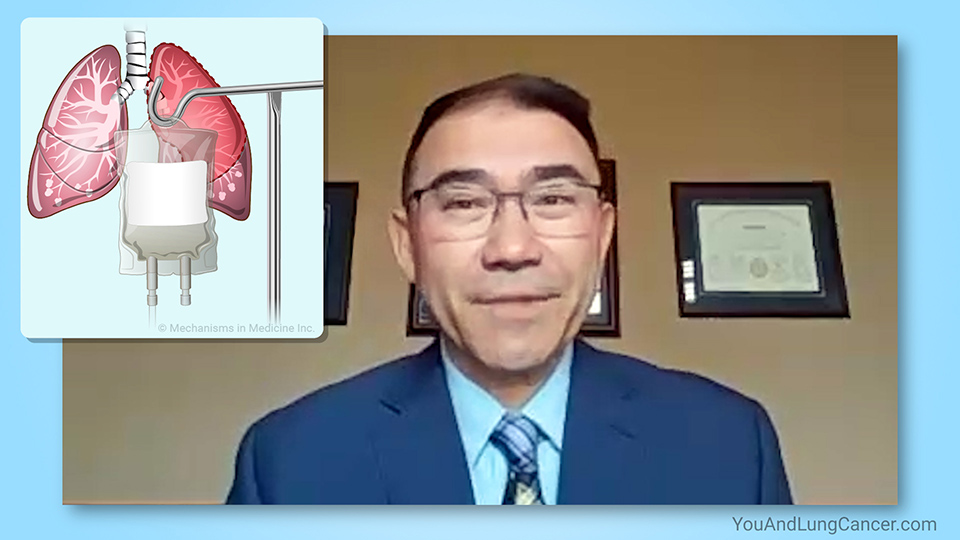 What are the treatment options for small cell lung cancer (SCLC)?