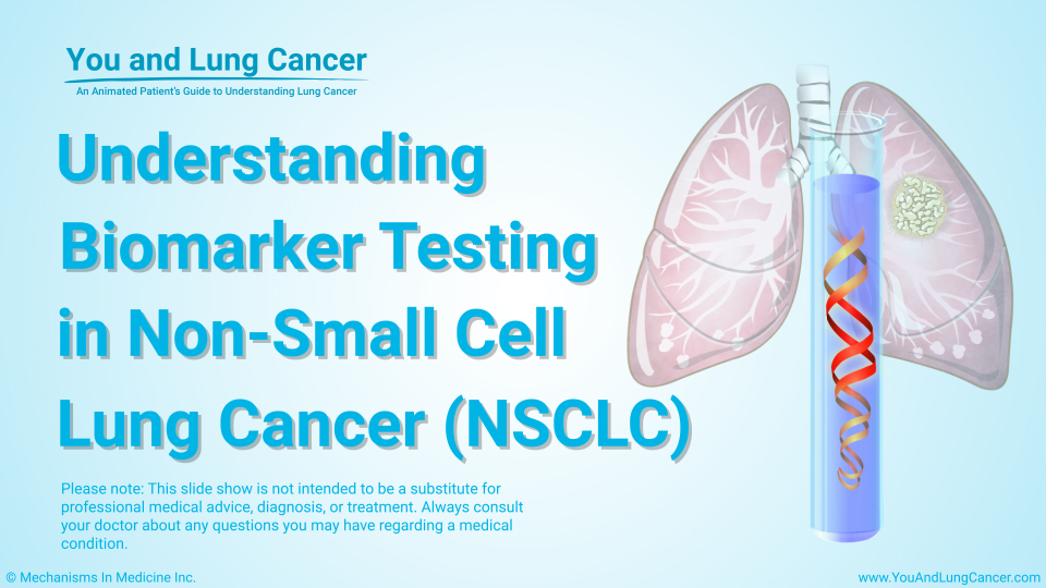 Understanding Biomarker Testing in Non-Small Cell Lung Cancer