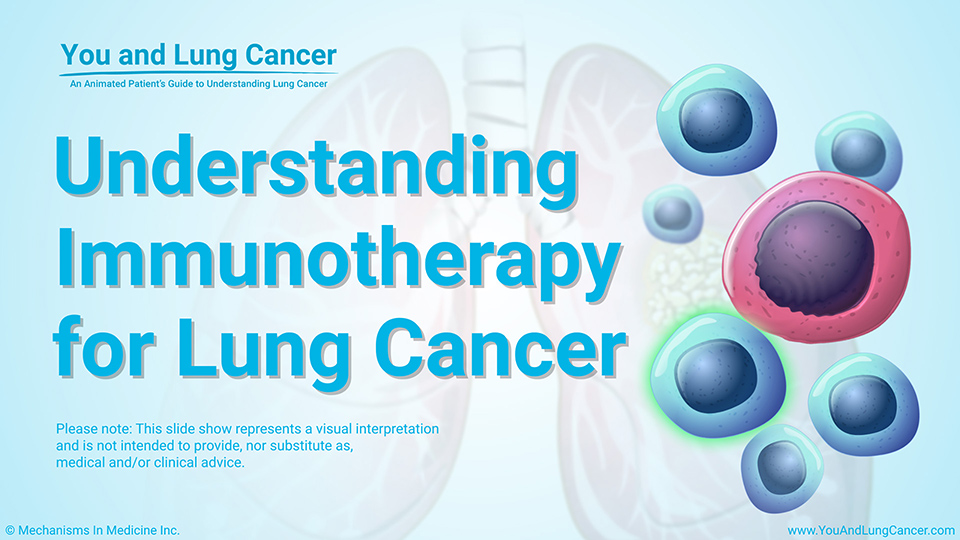Slide Show - Understanding Immunotherapy for Lung Cancer
