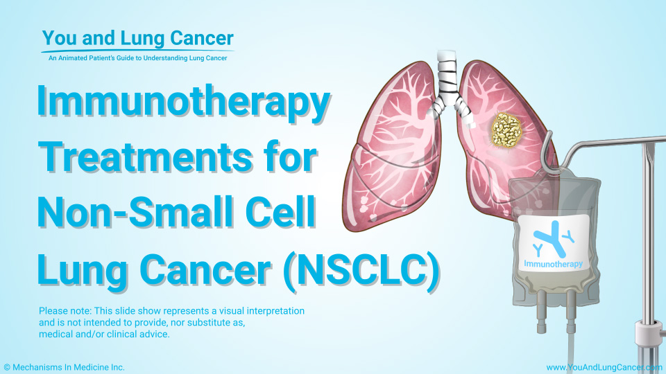 Slide Show - Immunotherapy Treatments for NSCLC