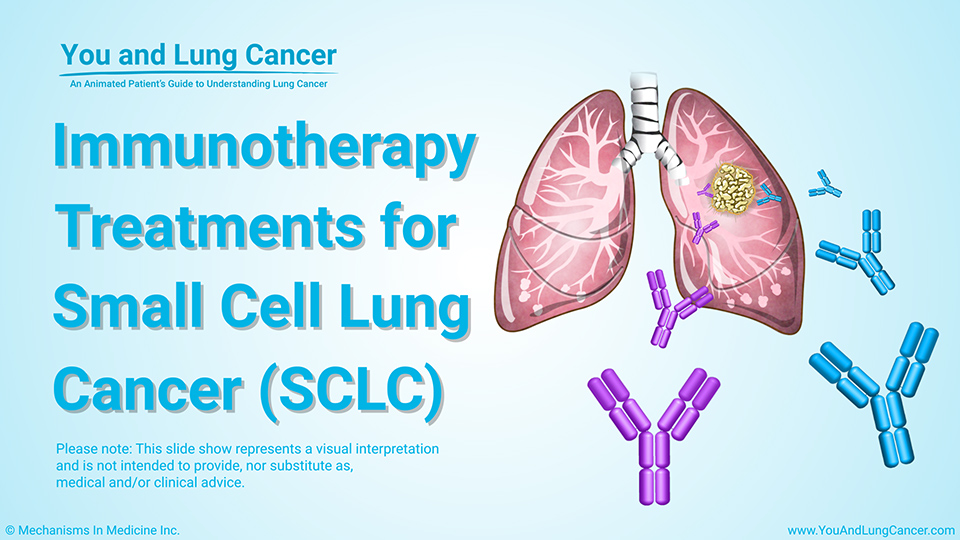 Slide Show - Immunotherapy Treatments for SCLC