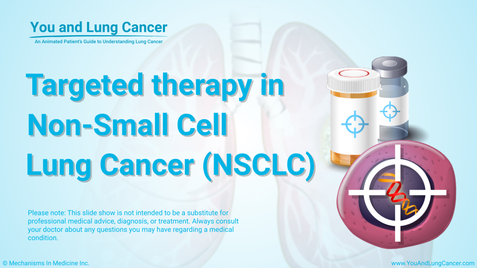Targeted Therapy in Non-Small Cell Lung Cancer