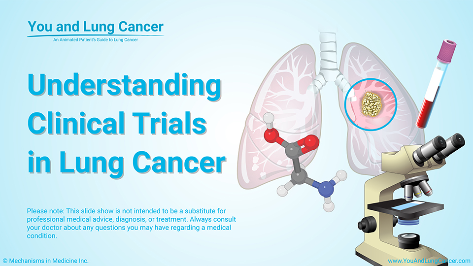 Slide Show - Understanding Clinical Trials in Lung Cancer
