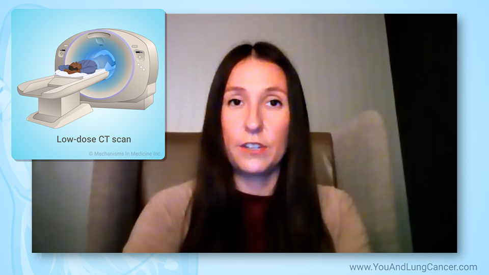 What should I expect during a low-dose CT scan to screen for lung cancer?