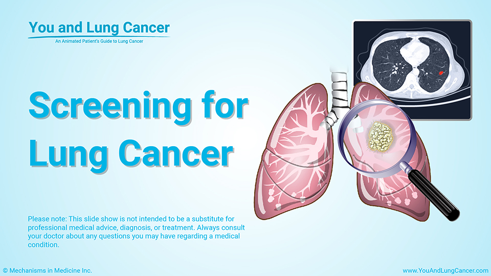 Slide Show - Screening for Lung Cancer