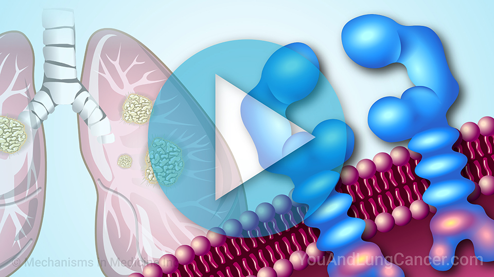 NSCLC Treatment When You Have an EGFR Mutation