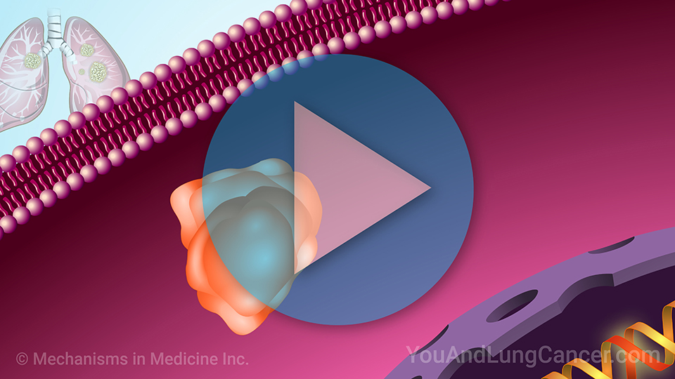 NSCLC Treatment When You Have a KRAS Mutation