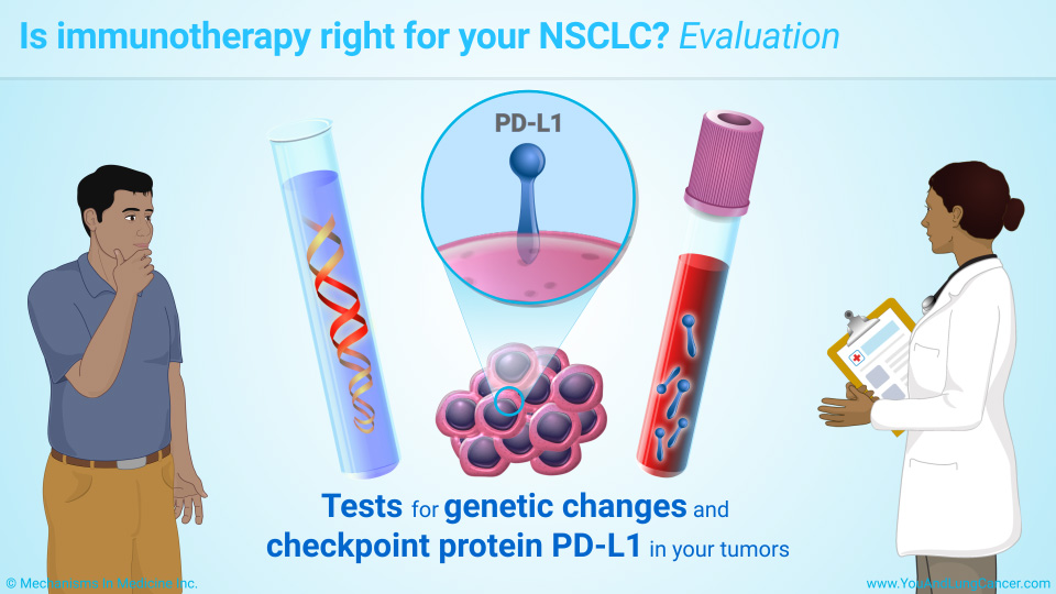 Is immunotherapy right for your NSCLC? Evaluation