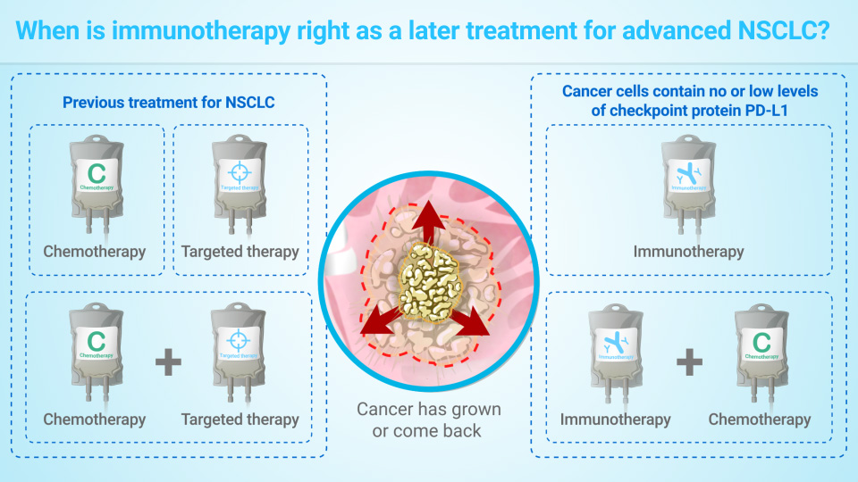 When is immunotherapy right as a later treatment for advanced NSCLC?
