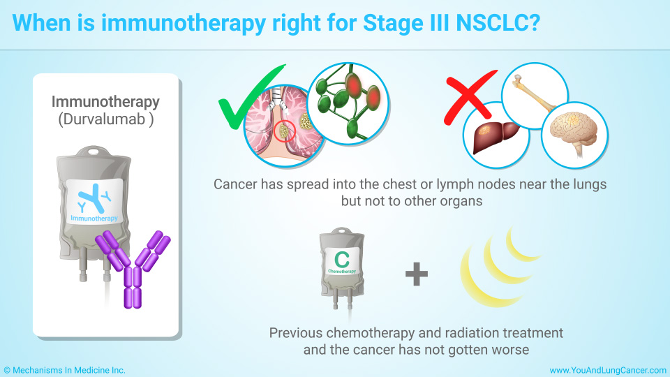 When is immunotherapy right for Stage III NSCLC?