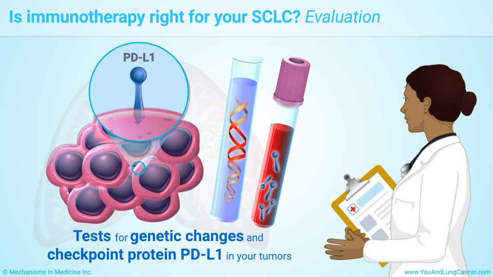 Is immunotherapy right for your SCLC? Evaluation