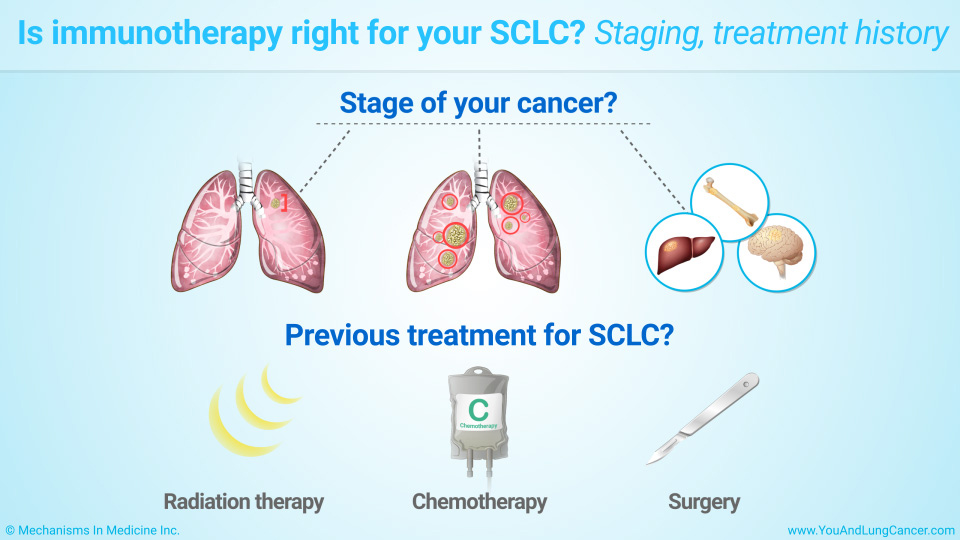 Is immunotherapy right for your SCLC? Staging, treatment history