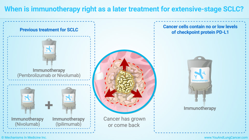 When is immunotherapy right as a later treatment for extensive-stage SCLC?