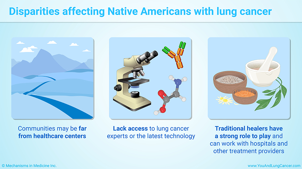 Disparities affecting Native Americans with lung cancer