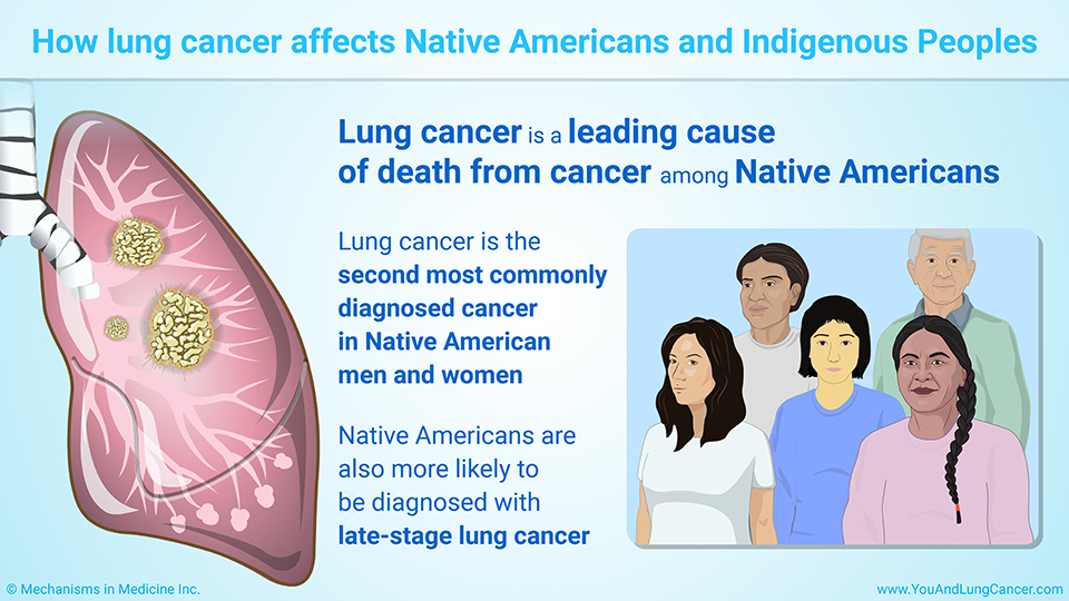 How lung cancer affects Native Americans and Indigenous Peoples