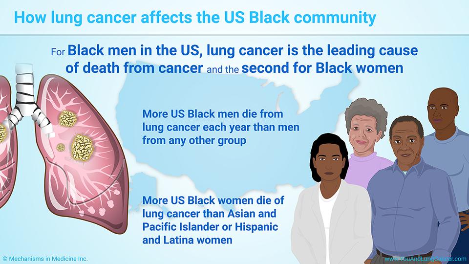 How lung cancer affects the US Black community