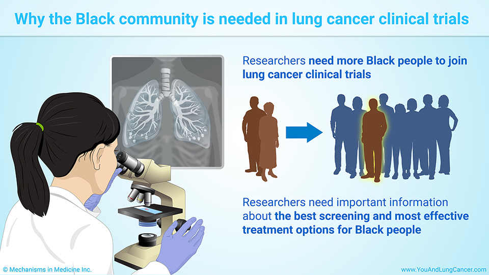 Why the Black community is needed in lung cancer clinical trials