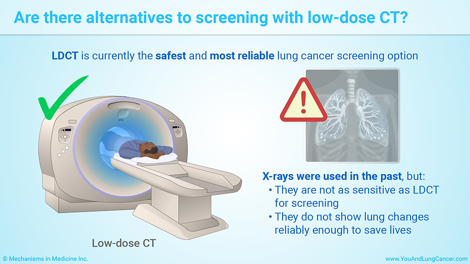 Are there alternatives to screening with low-dose CT?