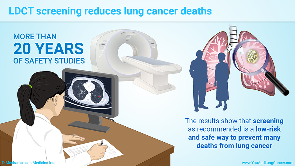 LDCT screening reduces lung cancer deaths