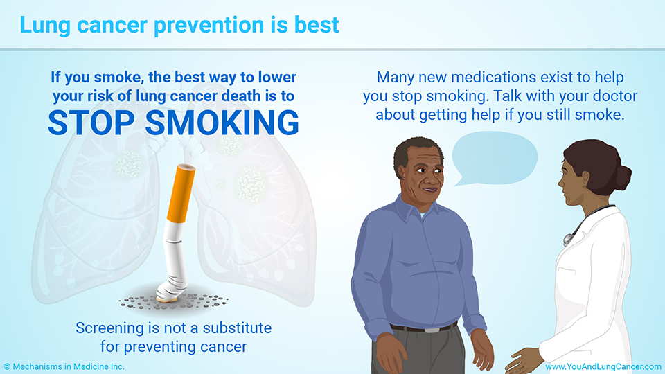 Lung cancer prevention is best