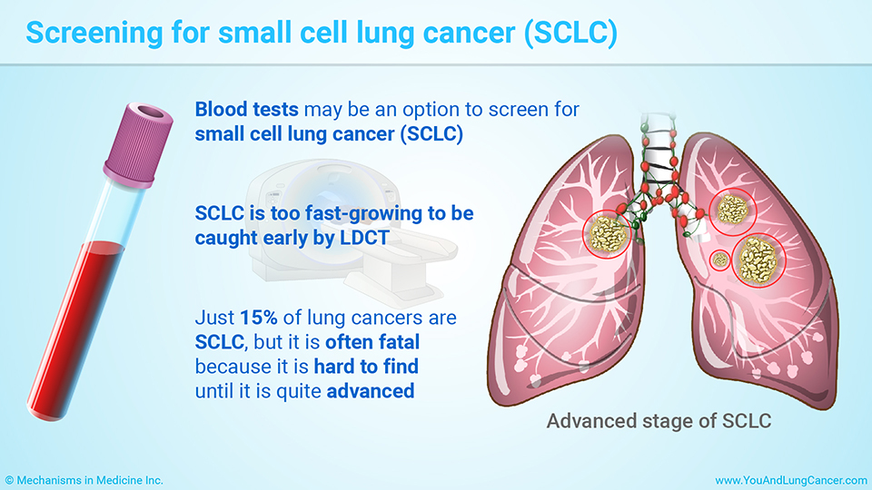 Screening for small cell lung cancer (SCLC)