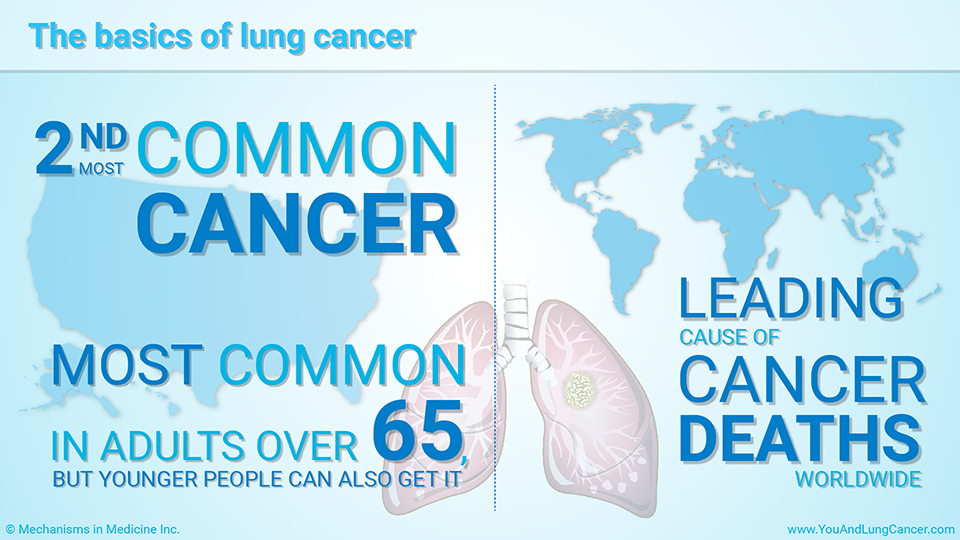 The basics of lung cancer