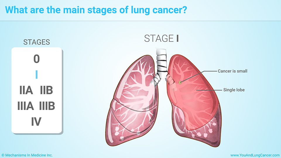 Stages of cancer. Lung Cancer classification. Vital capacity of the lungs. Lungs of the Earth. Tuberculosis pulmonum cavernosa rh.