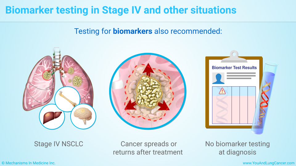 Biomarker testing in Stage IV and other situations
