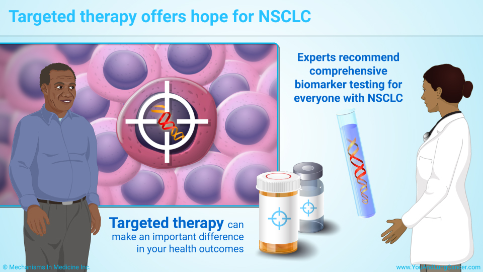 Targeted therapy offers hope for NSCLC