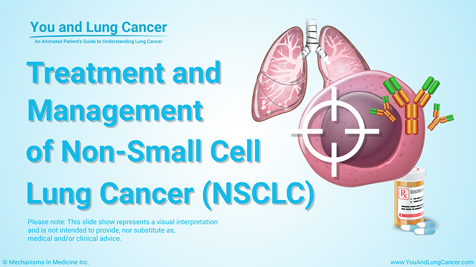presentation of non small cell lung cancer