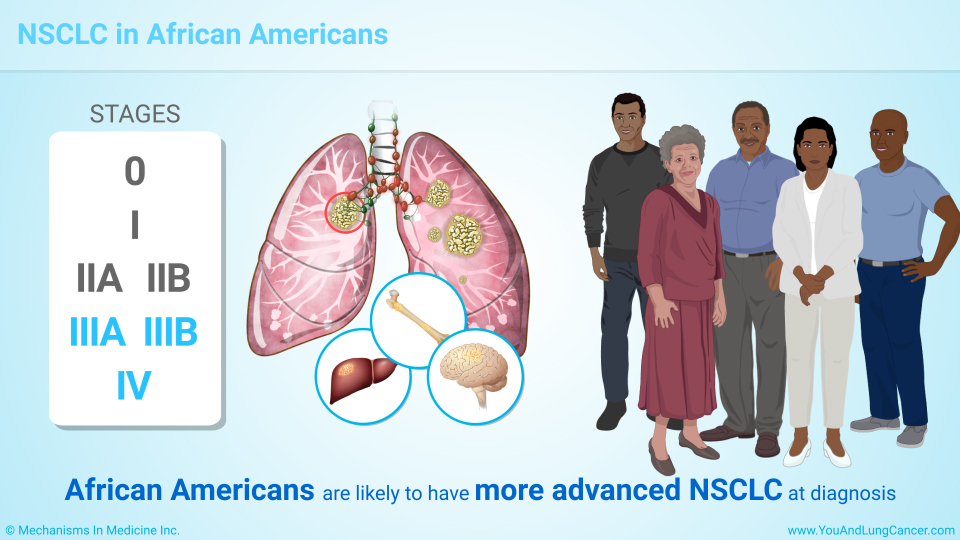 NSCLC in African Americans