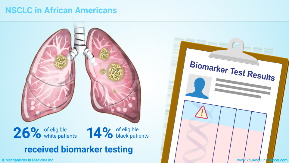 NSCLC in African Americans