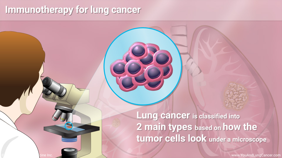 Immunotherapy for lung cancer
